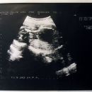 24.3.1998 (15t 3d)